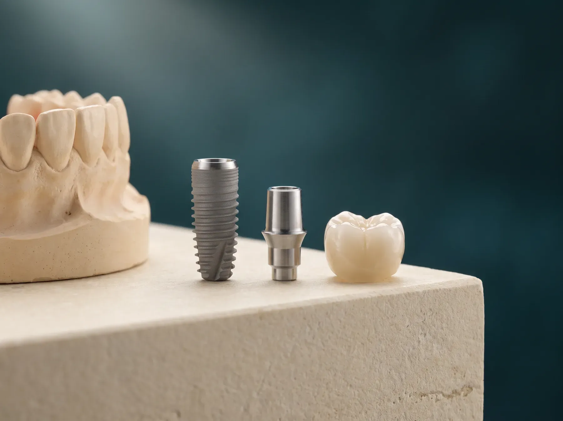 A titanium dental implant post, its abutment, and a ceramic crown set out beside a dental model.